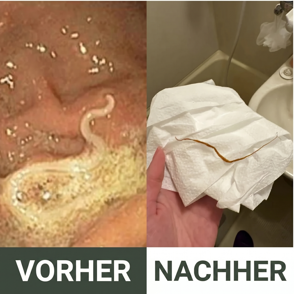 Bio-Rizinusöl Wickel