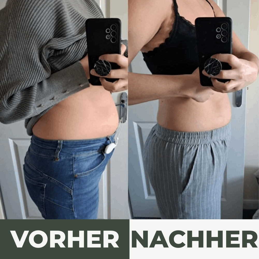 Vorher-Nachher: Blähbauch